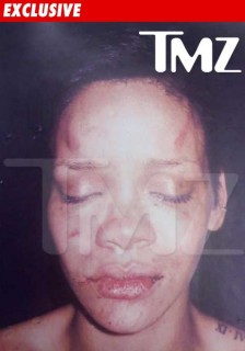 Rihanna's battered face