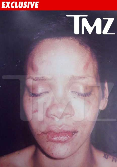 Rihanna's battered face