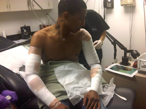 [PHOTO] Pharrell Williams Goes Through Painful Tattoo Removal Procedure