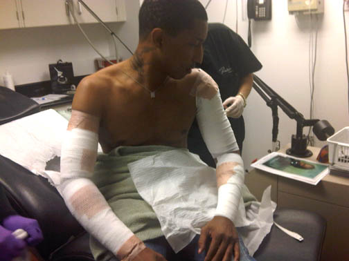 ti tattoos. his tattoos removed