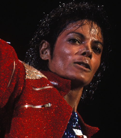 Proof of Michael Jackson's vitiligo