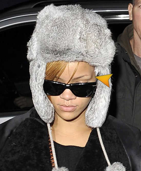 Rihanna (with a bump above her eye) leaving her hotel in London - November 15th 2009
