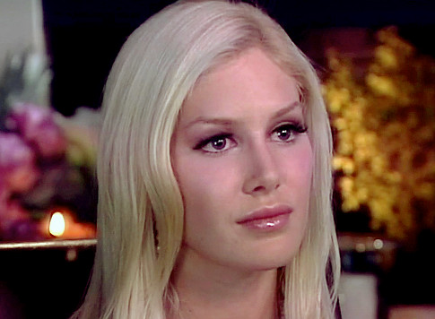 heidi montag after surgery people. Heidi Montag Screws Up Her