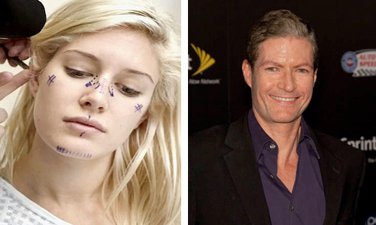 heidi montag plastic surgery face. Heidi Montag, who has