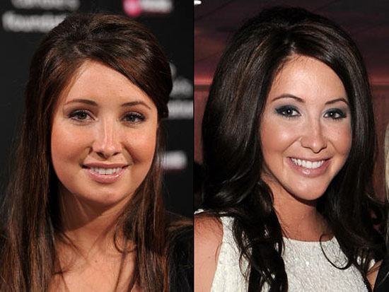 Bristol Palin Admits To Having Jaw Surgery