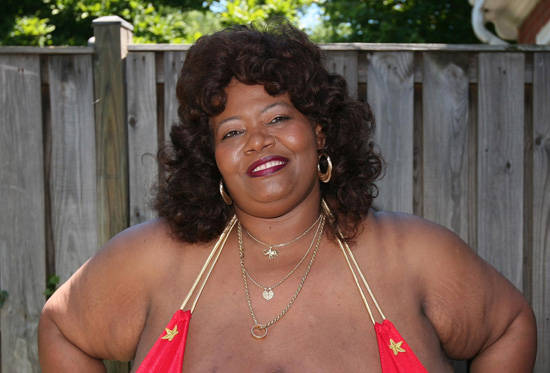 Meet the woman with the biggest breasts in the world.. Norma Stitz