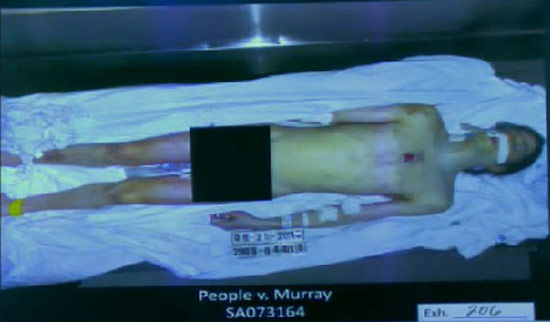 michael jackson autopsy photo leaked