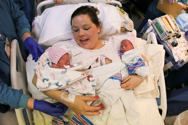 Mom Gives Birth To Rare Mono Mono Twins Holding Hands