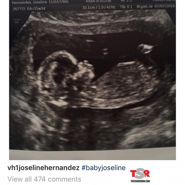 joseline-ultrasound