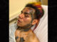 Tekashi 6ix9ine Reportedly Hospitalized After Being Kidnapped, Pistol-Whipped and Robbed at Gunpoint