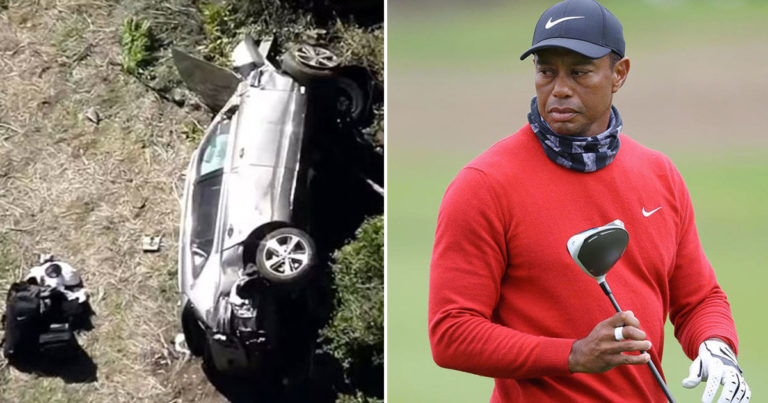 Tiger Woods Hospitalized With Multiple Leg Injuries After Serious Car