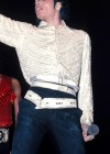 Proof of Michael Jackson’s vitiligo