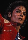 Proof of Michael Jackson’s vitiligo