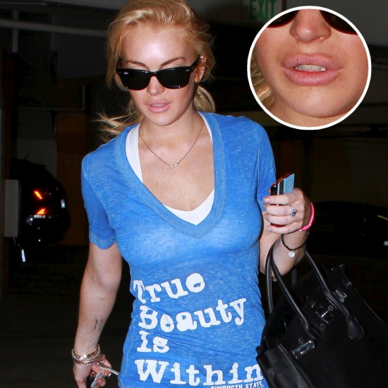 Lindsay Lohan Thinks True Beauty is Within......but Has Plumper Lips