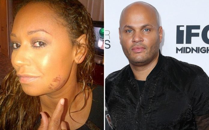 Mel B Granted Restraining Order After Claiming Estranged Husband ...