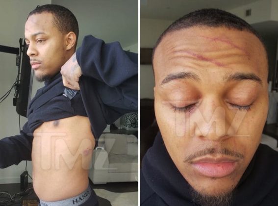 New Photos Show Bow Wows Girlfriend Kyomi Leslie Bit And Scratched Him In Violent Attack 4849